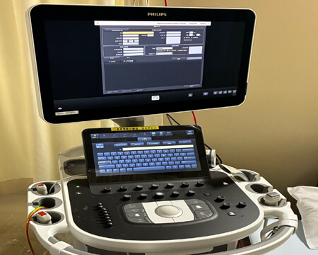 超音波診断装置