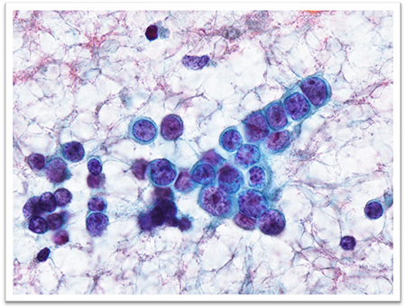 細胞診スクリーニング