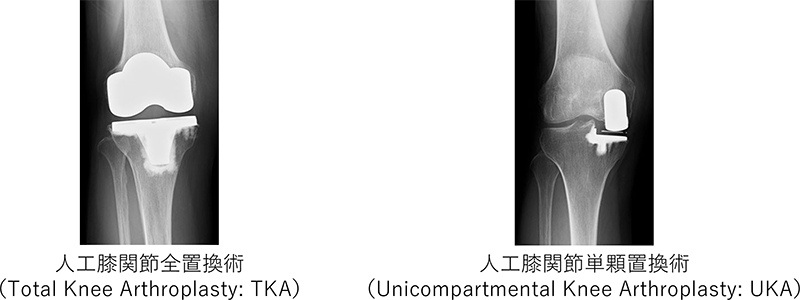 手術療法