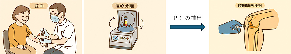 再生医療