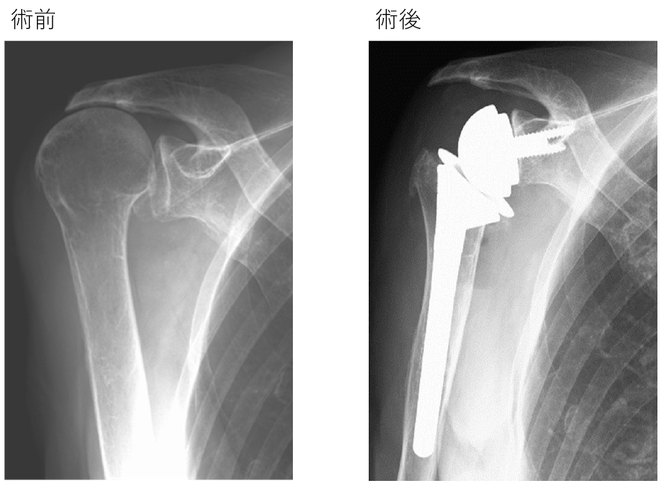 上肢・手外科センター