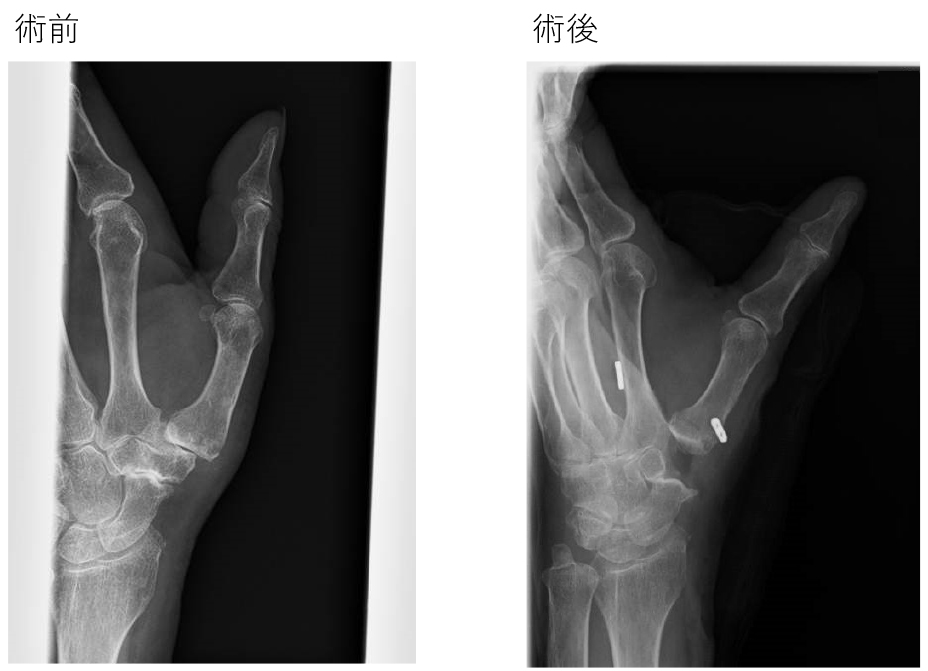 上肢・手外科センター